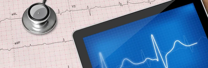 El electrocardiograma y sus distintas derivaciones